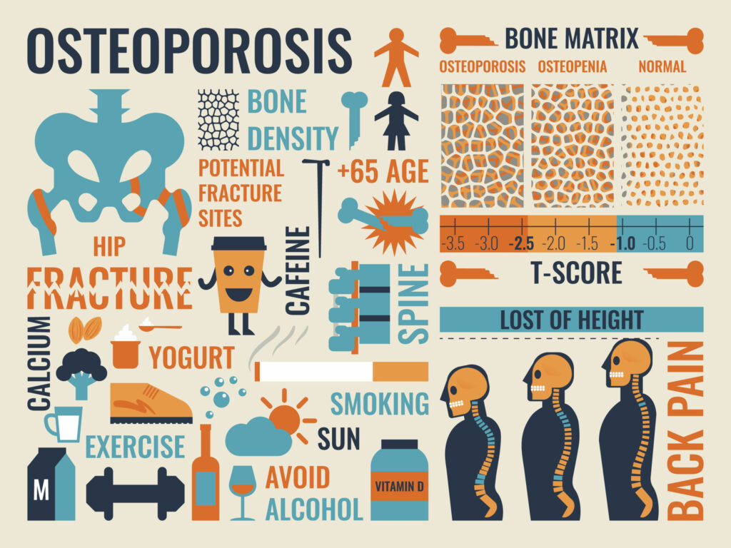 How to Build Stronger Bones at Any Age